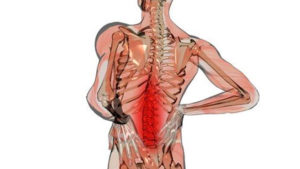 Dolor Lumbar - Asociación Andaluza del Dolor