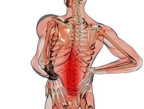 Dolor Lumbar - Asociación Andaluza del Dolor