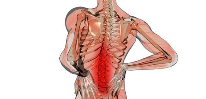 Dolor Lumbar - Asociación Andaluza del Dolor